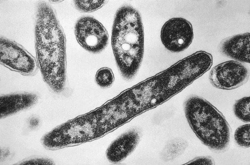 legionnaires' outbreak grows: what are the disease's first symptoms?