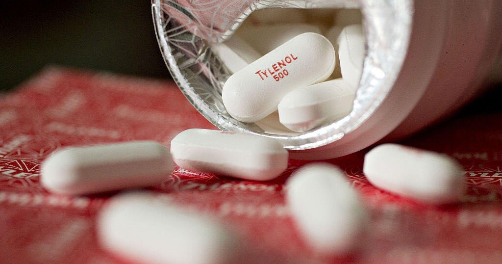 what the research says about tylenol and autism